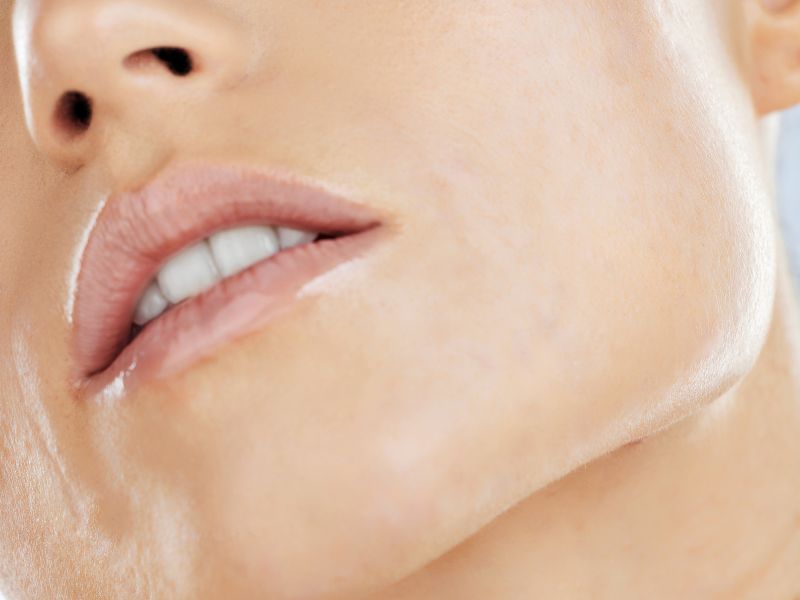 jawline augmentation